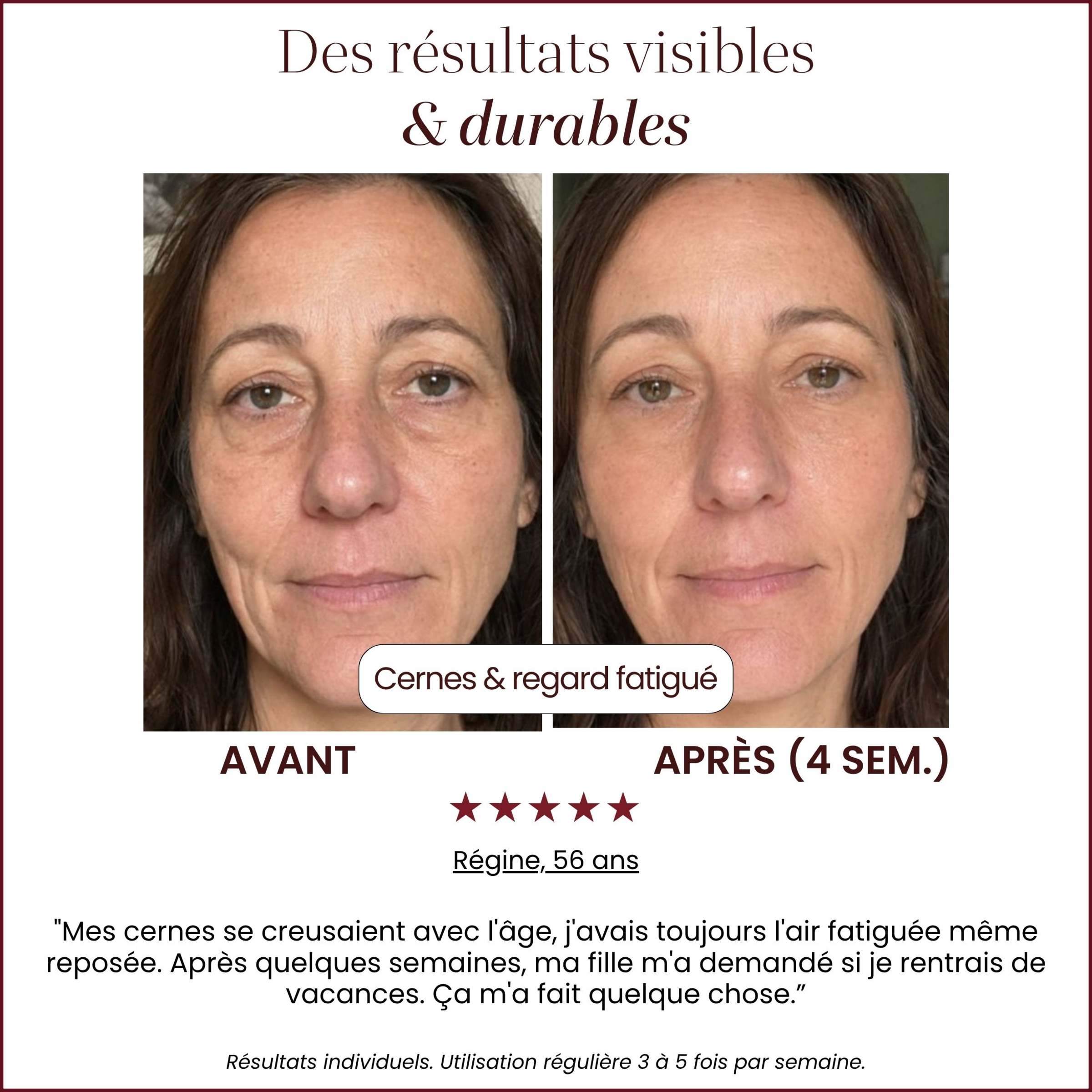 Auréa™ Precision LED Skincare Wand