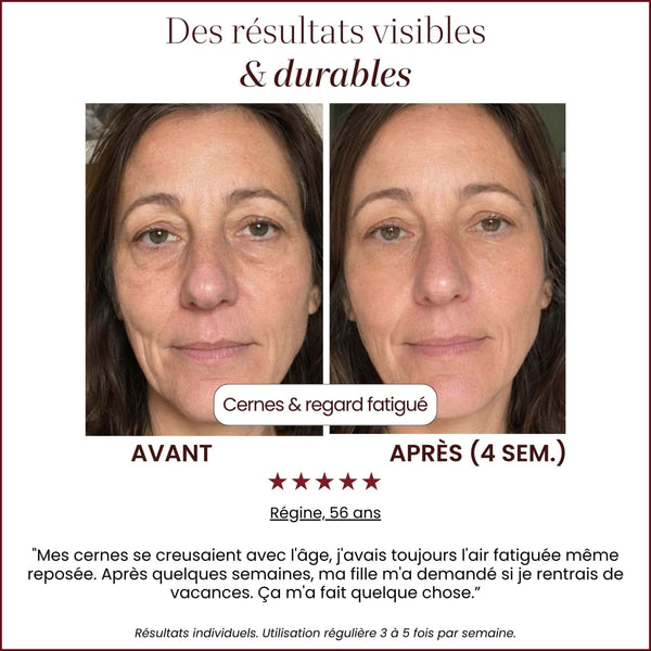 Auréa™ Precision LED Skincare Wand