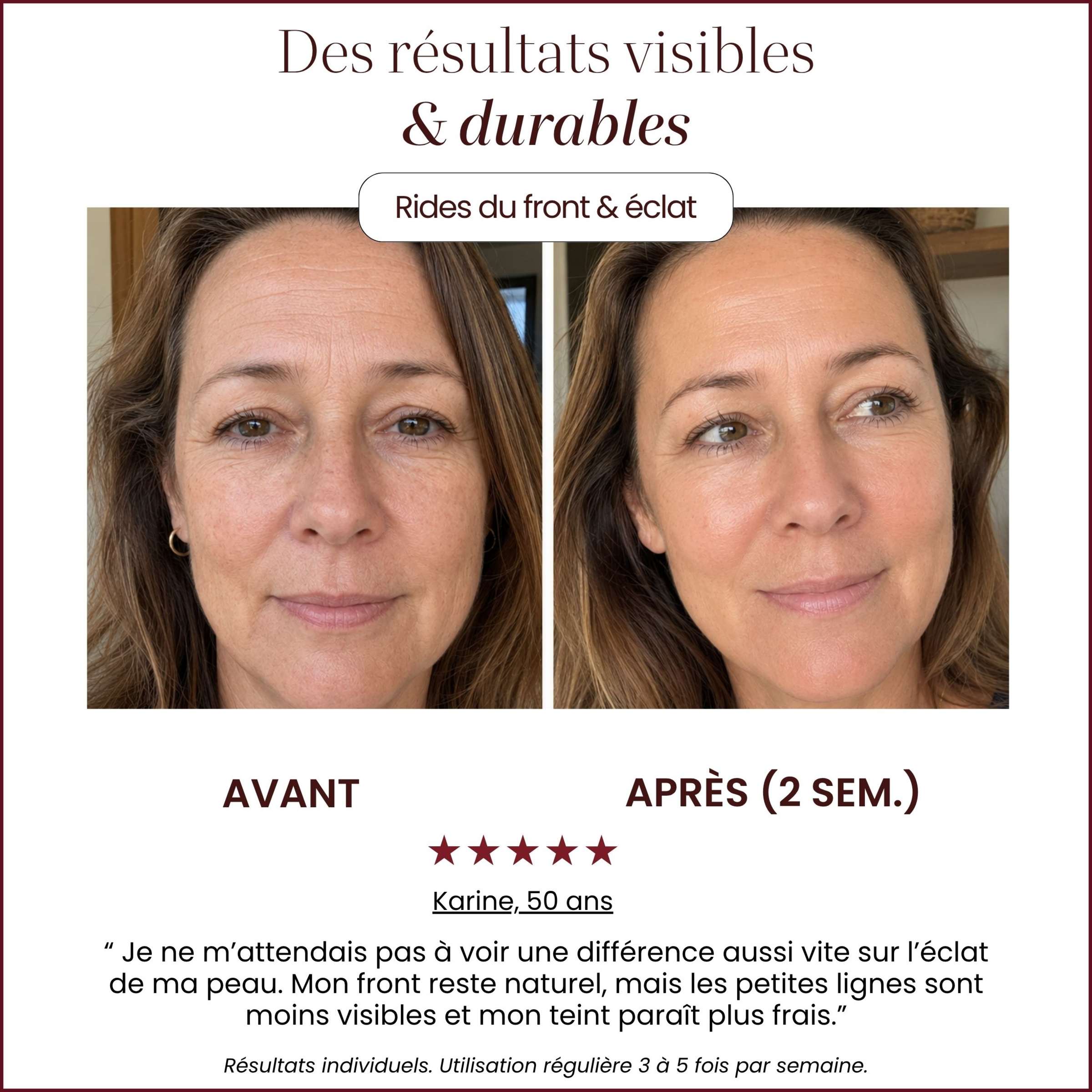 Auréa™ Precision LED Skincare Wand